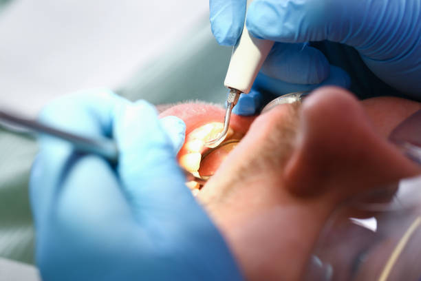 Best Walk-In Emergency Dentist in Sugar Grove, IL
