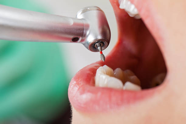 Best Emergency Broken Tooth Repair in Sugar Grove, IL